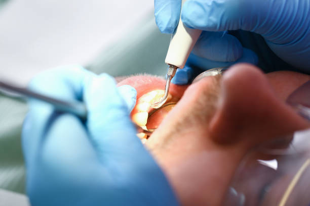 Best Broken or Cracked Tooth Emergency Dentist in Lake Secession, SC